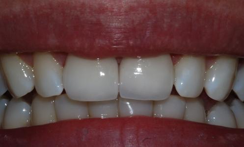 Dual_Arc_Dental_Front_Teeth