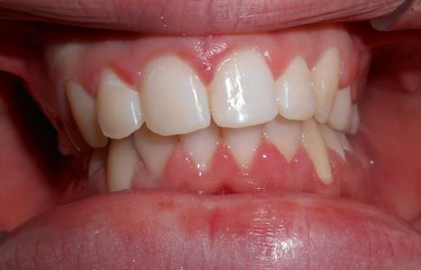 Dual_Arc_Dental_After